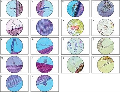 Variations in epidermal trichomes of a mystic weed Parthenium hysterophorus L. from semi-arid regions of Barmer, Rajasthan (India)